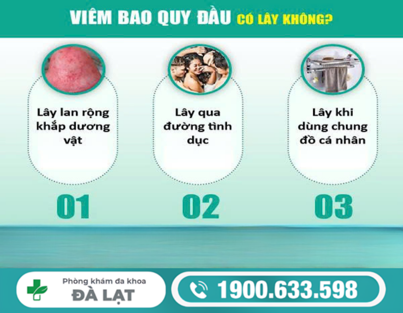 VIÊM BAO QUY ĐẦU CÓ LÂY KHÔNG VÀ CÁCH ĐIỀU TRỊ HIỆU QUẢ 