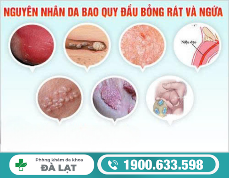 NGỨA BAO QUY ĐẦU CẢNH BÁO BỆNH GÌ? CÁC NGUYÊN NHÂN NAM GIỚI THƯỜNG BỎ QUA
