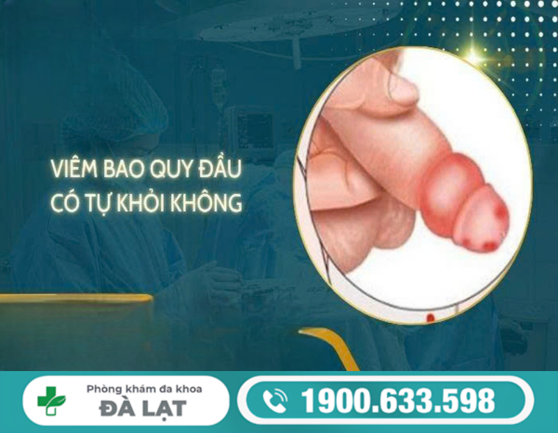 TÌNH TRẠNG VIÊM BAO QUY ĐẦU Ở NAM GIỚI CÓ TỰ KHỎI KHÔNG? CHUYÊN GIA GIẢI ĐÁP CHI TIẾT