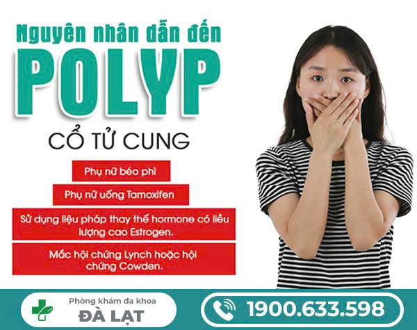 Nguyên Nhân Dẫn Đến Polyp Cổ Tử Cung 