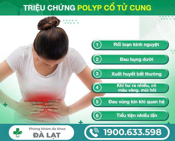 Hỏi Đáp Về Bệnh Polyp Cổ Tử Cung 