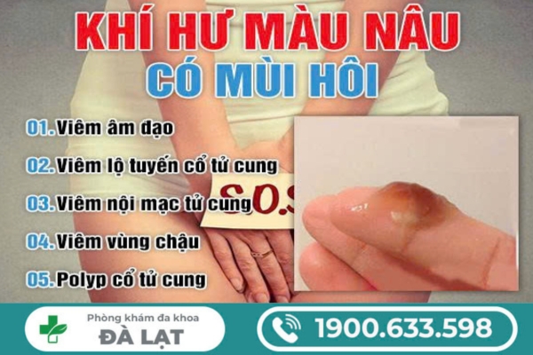 Hiện Tượng Ra Khí Hư Màu Nâu Có Mùi Hôi 