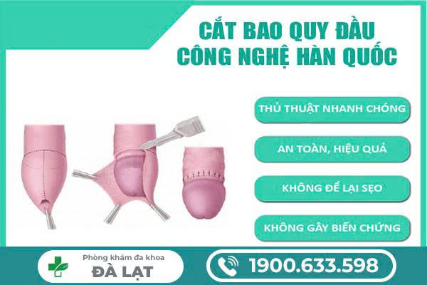 TƯ VẤN CHI TIẾT VỀ CẮT HẸP BAO QUY ĐẦU Ở NAM GIỚI BẰNG CÔNG NGHỆ HIỆN ĐẠI 