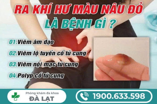 Hiện Tượng Ra Khí Hư Màu Nâu Đỏ 