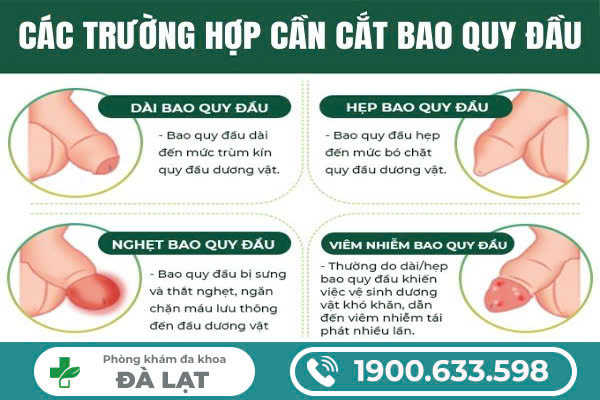 BAO QUY ĐẦU DÀI VÀ HẸP Ở NAM GIỚI: KHI NÀO CẦN CAN THIỆP ĐỂ TRÁNH BIẾN CHỨNG