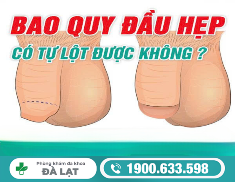 BAO QUY ĐẦU HẸP Ở NAM GIỚI CÓ TỰ LỘT ĐƯỢC KHÔNG? DẤU HIỆU NHẬN BIẾT VÀ CÁCH XỬ LÝ