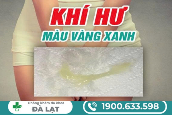 Khí Hư Màu Vàng Xanh Cảnh Báo Bệnh Gì? 