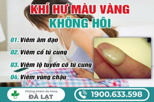Ra Khí Hư Màu Vàng Không Hôi Là Dấu Hiệu Của Bệnh Gì? 
