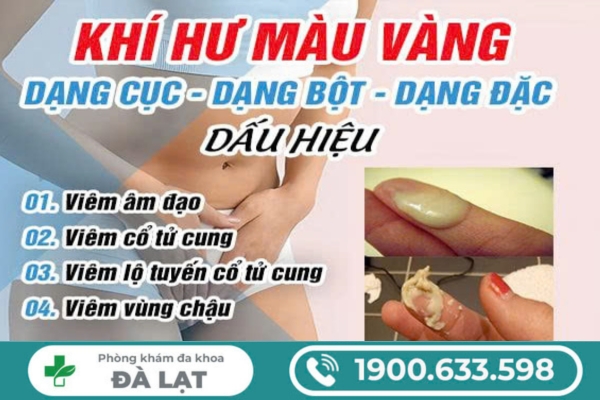 Khí Hư Màu Vàng Dạng Cục, Dạng Bột, Dạng Đặc 