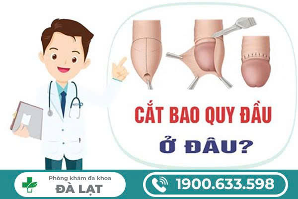 CẮT DÀI BAO QUY ĐẦU Ở ĐÂU AN TOÀN VÀ UY TÍN CHO NAM GIỚI