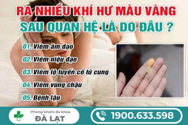 Ra Nhiều Khí Hư Sau Quan Hệ Là Bệnh Gì? 