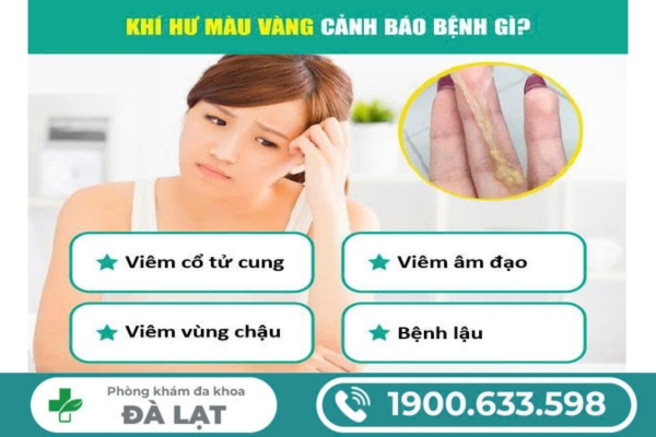 Tìm Hiểu: Khí Hư Màu Vàng Là Bệnh Gì? 