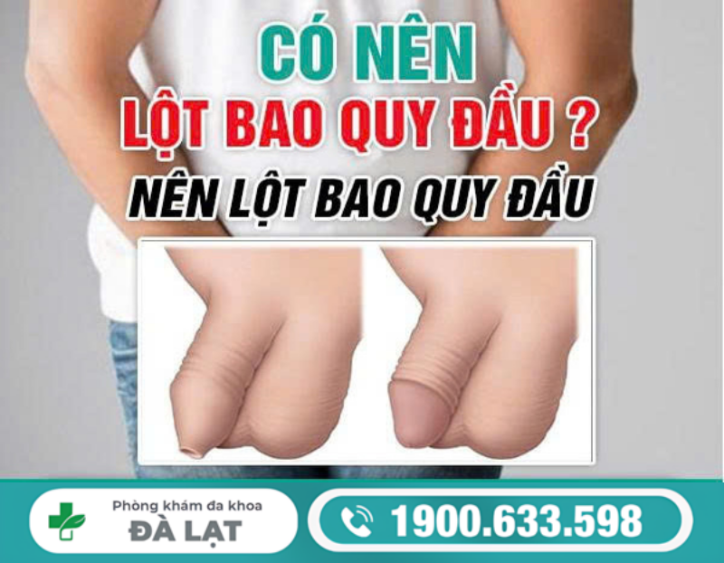 LỘT BAO QUY ĐẦU ĐÚNG CÁCH GIÚP NAM GIỚI PHÒNG NGỪA BỆNH NAM KHOA