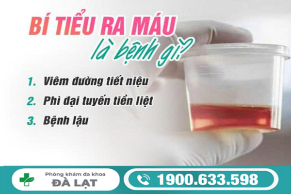 BÍ TIỂU TIỂU RA MÁU Ở NAM GIỚI DO ĐÂU? CẢNH BÁO CÁC BỆNH NAM KHOA 
