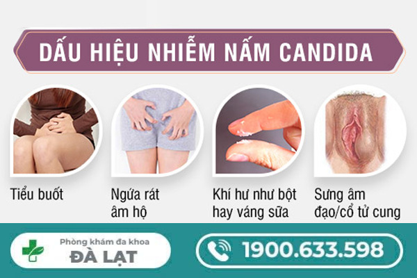 Tìm Hiểu Biểu Hiện Khi Bị Nấm Candida 