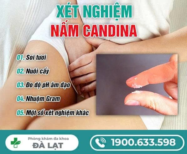 Xét Nghiệm Nấm Candida Như Thế Nào? 