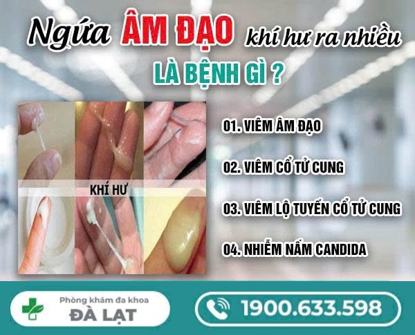 Tìm Hiểu Về: Ngứa Âm Đạo Khí Hư Ra Nhiều Là Bệnh Gì? 