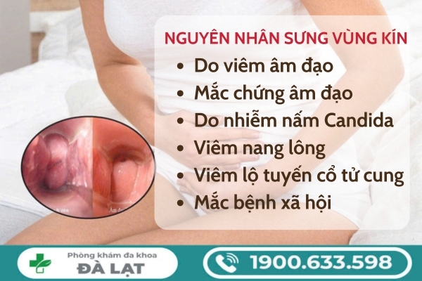 Hiện Tượng: Sưng Ngứa Đỏ Vùng Kín 