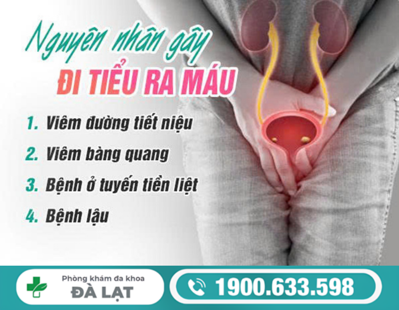 CÁC NGUYÊN NHÂN PHỔ BIẾN KHIẾN NAM GIỚI ĐI TIỂU RA MÁU CẦN CHÚ Ý