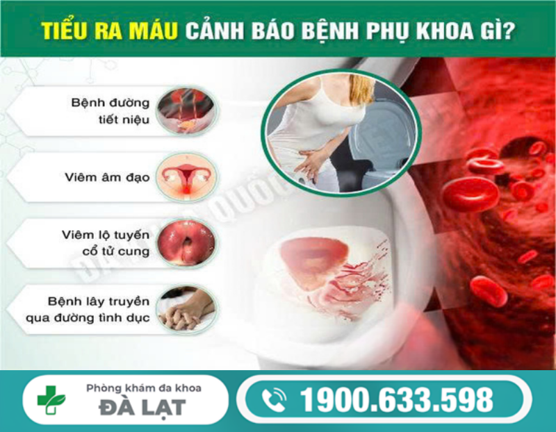 ĐI TIỂU RA MÁU Ở NỮ GIỚI LÀ BỆNH GÌ? NGUYÊN NHÂN VÀ MỨC ĐỘ NGUY HIỂM 