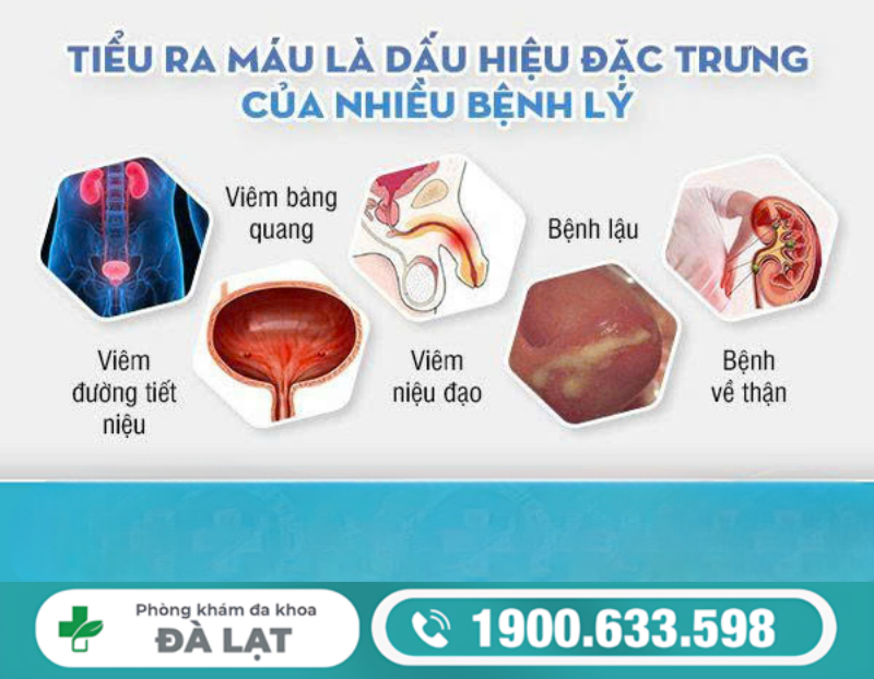 TIỂU RA MÁU: DẤU HIỆU CẢNH BÁO BỆNH NGUY HIỂM Ở CẢ NAM VÀ NỮ 