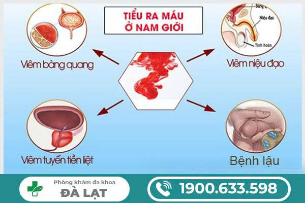 NAM GIỚI TIỂU RA MÁU: DẤU HIỆU BỆNH LÝ NGUY HIỂM CẦN BIẾT 