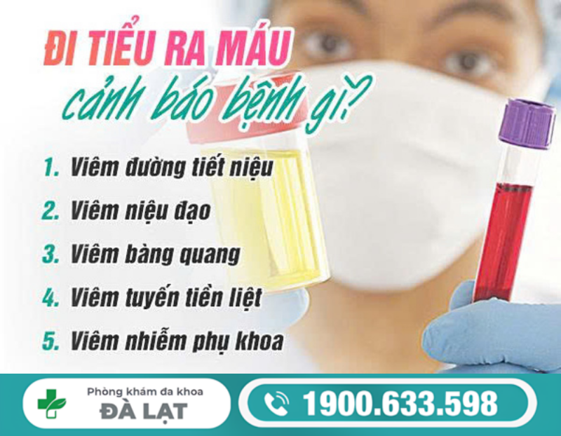 HIỆN TƯỢNG ĐI TIỂU RA MÁU Ở NAM GIỚI: NGUYÊN NHÂN VÀ MỨC ĐỘ NGUY HIỂM 