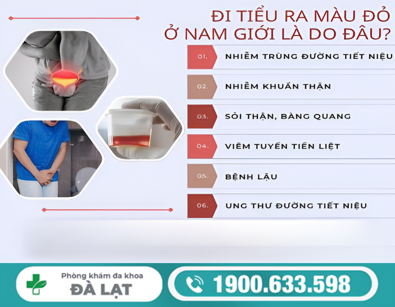 CHỮA TIỂU RA MÁU Ở NAM GIỚI: PHÁC ĐỒ ĐIỀU TRỊ HIỆN ĐẠI 