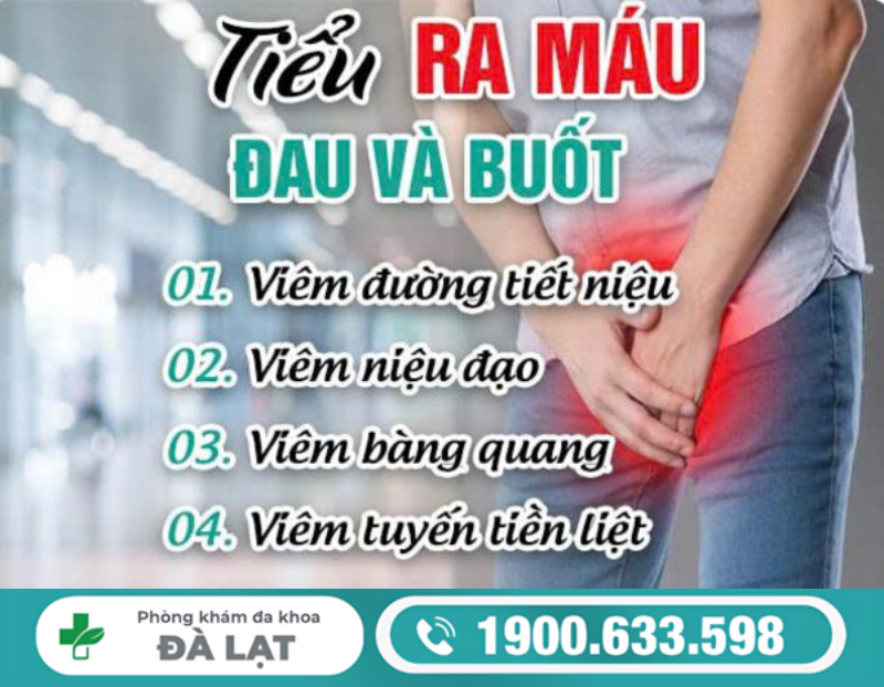 ĐI TIỂU RA MÁU KÈM ĐAU BUỐT Ở NAM GIỚI: DẤU HIỆU CẢNH BÁO BỆNH NGUY HIỂM 