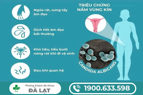 Bị Nấm Vùng Kín Có Được Quan Hệ Không? 