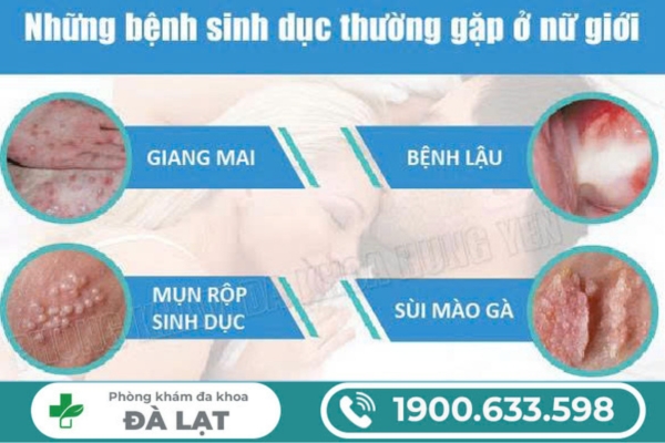 Bệnh Sinh Dục Ở Nữ Giới Thường Gặp 