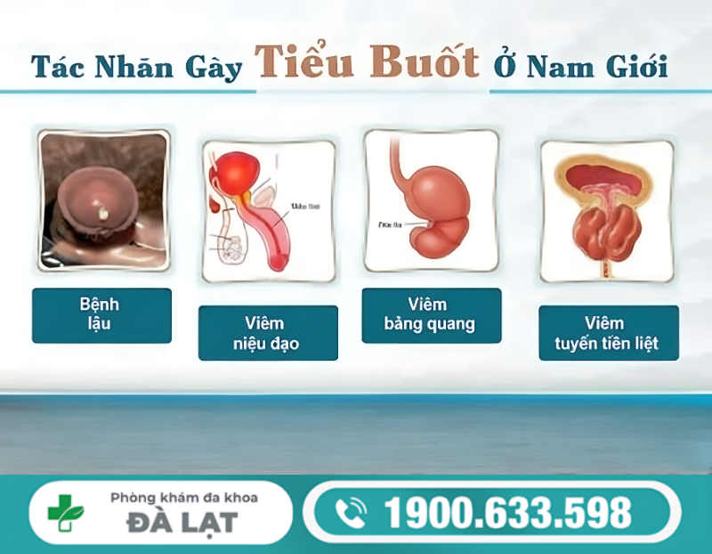 ĐI TIỂU BUỐT Ở NAM GIỚI KHÁM Ở ĐÂU CHO KẾT QUẢ CHÍNH XÁC?