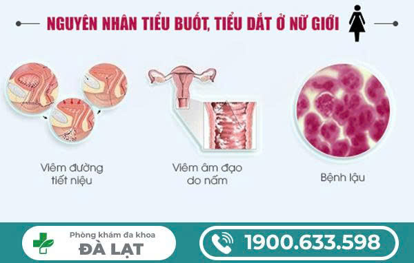 TIỂU RẮT Ở NỮ: NGUYÊN NHÂN PHỔ BIẾN VÀ HỆ LỤY NGUY HIỂM NẾU KHÔNG ĐIỀU TRỊ