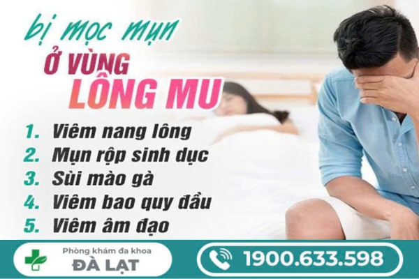 Bị Mọc Mụn Ở Lông Mu Vùng Kín 