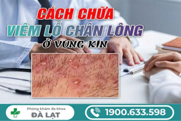 Cách Chữa Viêm Lỗ Chân Lông Vùng Kín 