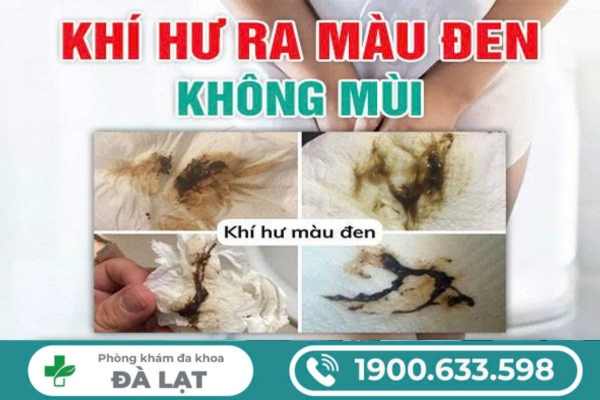 Hiện Tượng: Ra Khí Hư Màu Đen Không Mùi 