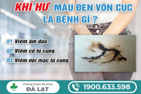 Hiện Tượng Khí Hư Màu Đen Vón Cục 