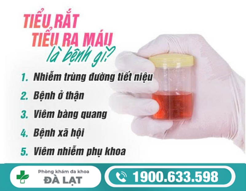 TIỂU RẮT, TIỂU BUỐT RA MÁU Ở NAM VÀ NỮ CẢNH BÁO CÁC BỆNH LÝ NGUY HIỂM 