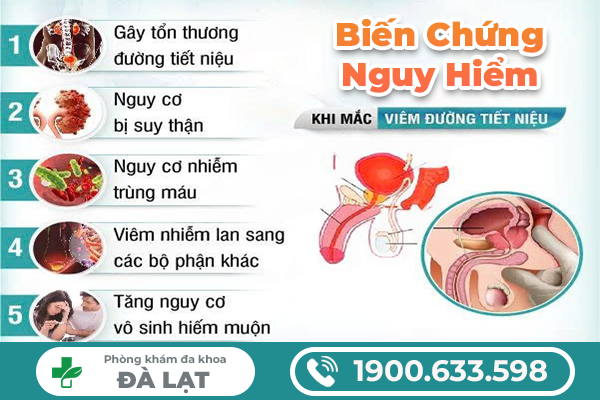 VIÊM ĐƯỜNG TIẾT NIỆU Ở NAM GIỚI: DẤU HIỆU NHẬN BIẾT VÀ CÁCH ĐIỀU TRỊ 