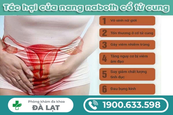 Nang Naboth Cổ Tử Cung Có Ảnh Hưởng Gì Không? 