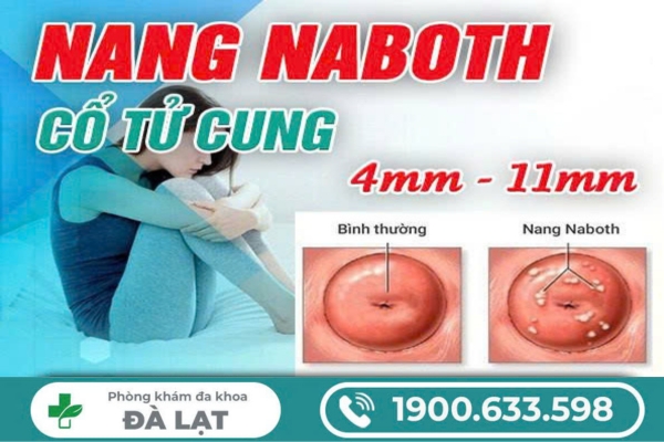 Nang Naboth Cổ Tử Cung Kích Thước 4mm - 11mm