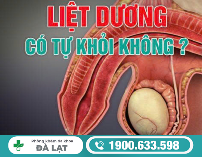 LIỆT DƯƠNG CÓ TỰ KHỎI KHÔNG? GIẢI ĐÁP CỦA BÁC SĨ CHUYÊN KHOA 