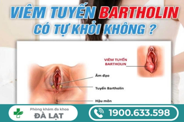 Viêm Tuyến Bartholin Có Tự Khỏi Không? 