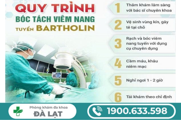 Tìm Hiểu Phương Pháp Điều Trị Viêm Tuyến Bartholin 
