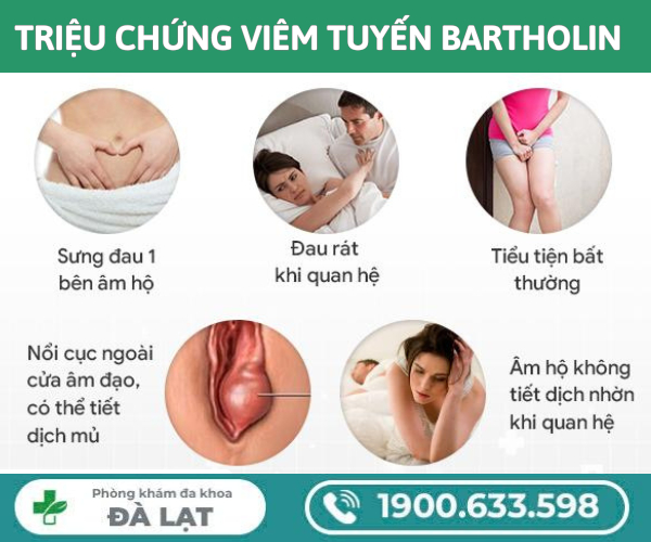 Dấu Hiệu, Triệu Chứng Viêm Tuyến Bartholin 