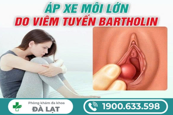 Áp Xe Môi Lớn: Nguyên Nhân, Biến Chứng và Cách Điều Trị 