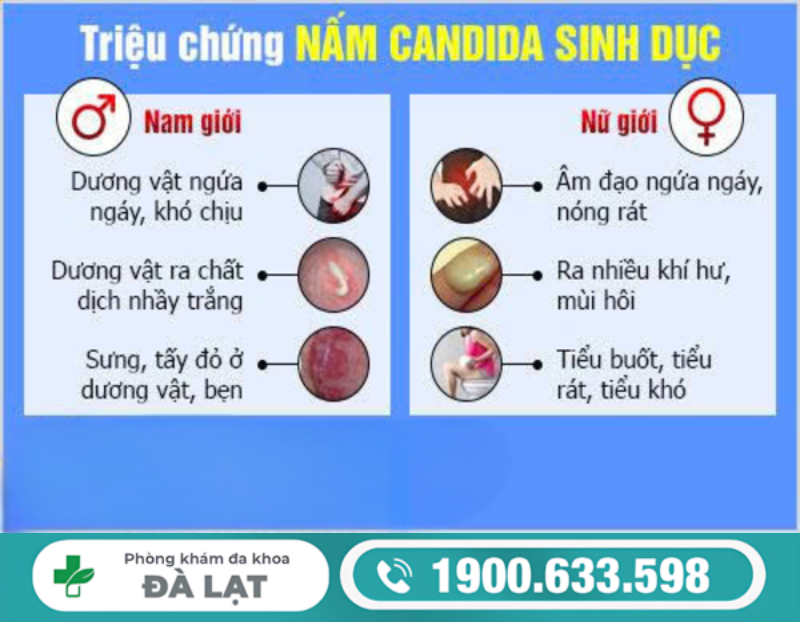BỆNH NẤM SINH DỤC Ở NAM VÀ NỮ: DẤU HIỆU NHẬN BIẾT SỚM