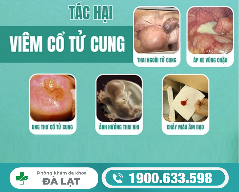 Viêm Cổ Tử Cung Có Ảnh Hưởng Gì Không? 