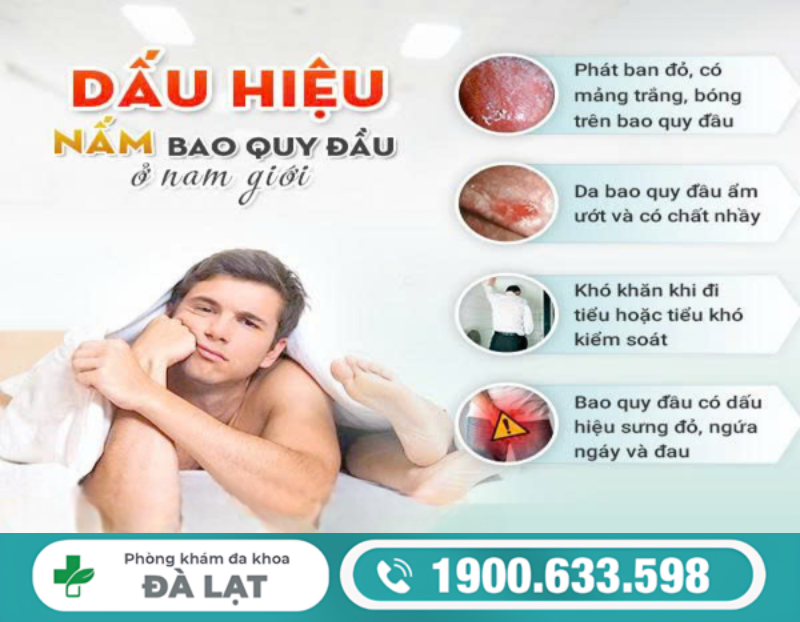 DẤU HIỆU NẤM BAO QUY ĐẦU CẢNH BÁO VIÊM NHIỄM NAM KHOA NGUY HIỂM 