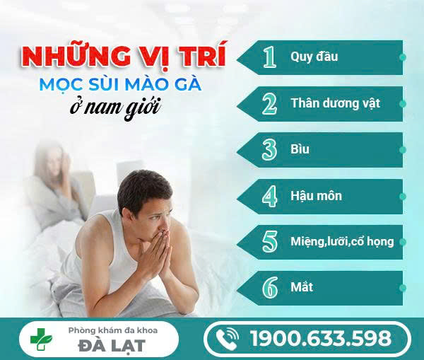SÙI MÀO GÀ Ở ĐẦU KHẤC: NHẬN BIẾT SỚM ĐỂ TRÁNH BIẾN CHỨNG NGUY HIỂM 